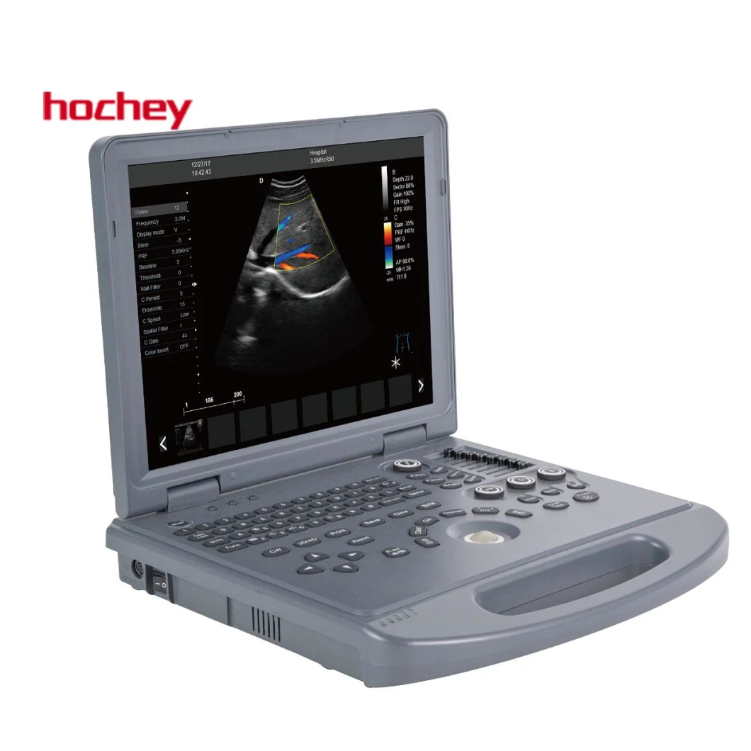 Hochey Medical 4D Color Doppler Ultrasound 15 Inch LED Medicinal Monitor LED Screen Scasnner with Multi-Languages Use